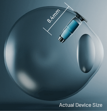 Slider infographic: Eye with implant